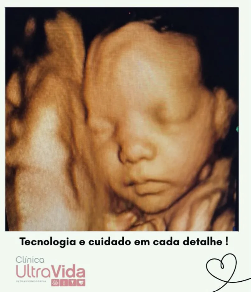 Ultrassonografia Obstétrica: muito mais do que ver o rostinho do bebê